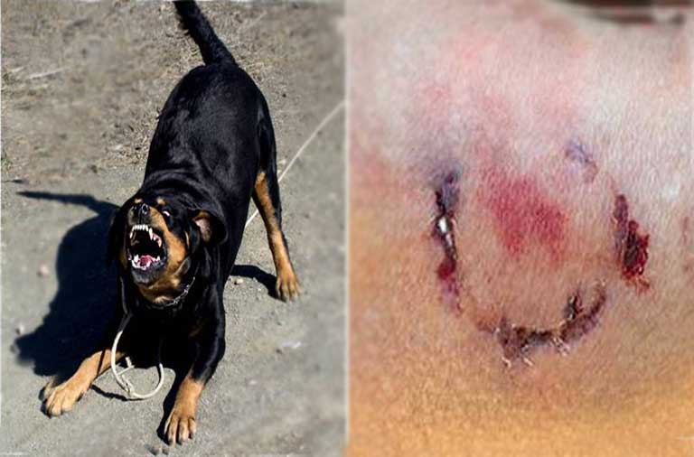 Woman bitten by dog owner