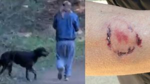 Woman bitten by dog owner