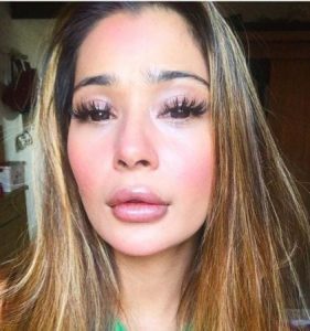 sara khan plastic surgery gone wrong