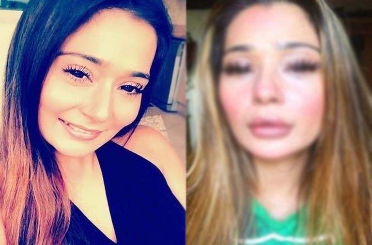 sara khan plastic surgery gone wrong